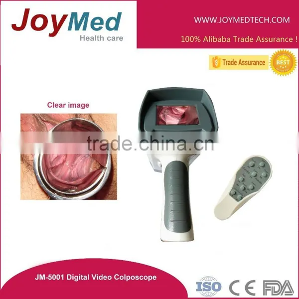 Colposcope Video Colposcope
