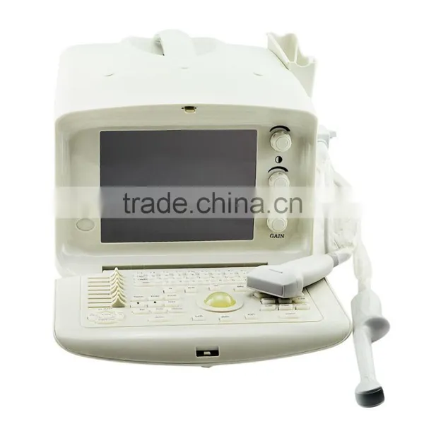 2016 New Digital Portable Ultrasound Scanner Good Quality Low Price photo-5