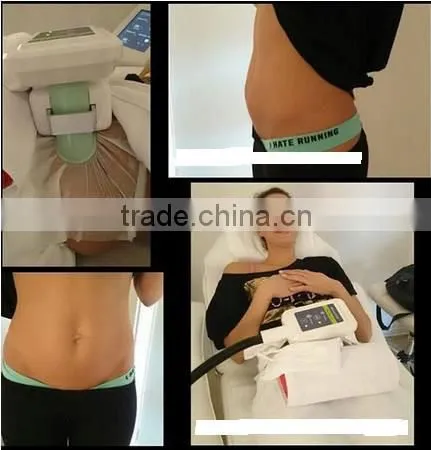 3 Cryo Handle Cryotherapy Cool Tech Liposuction Fat Freezing Machine photo-6