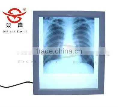 X-RAY Film Viewer Medical Manufacture