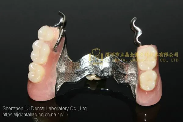 Dental Precision Attachment, Dental Attachment, Dental Denture, Laboratoire Dentaire, Dentallabor, Laboratorio Dental, Dental Laboratory, Shenzhen LJ Dental Lab China photo-5