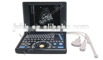 CE Approved Notebook Ultrasound Scanner With 3.5Mhz Multi-frequency Convex Probe RUS-9000E2 photo-2