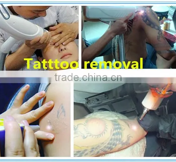 2000mj Strong Power Factory Direct Q 800mj Switch Nd Yag Laser Tattoo Removal Machine Permanent Tattoo Removal photo-6