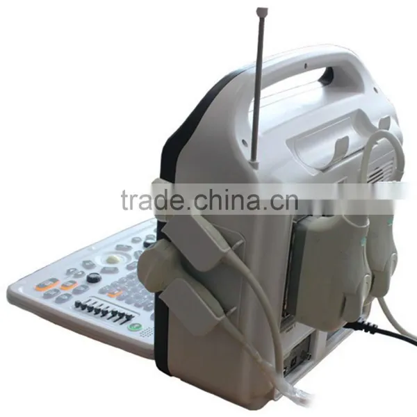 2016 New 3D 4D Color Doppler Ultrasound Machine With CFM, PW, CDE, CCD, HPRF Modes Quality Choice Supplier's Ch photo-2