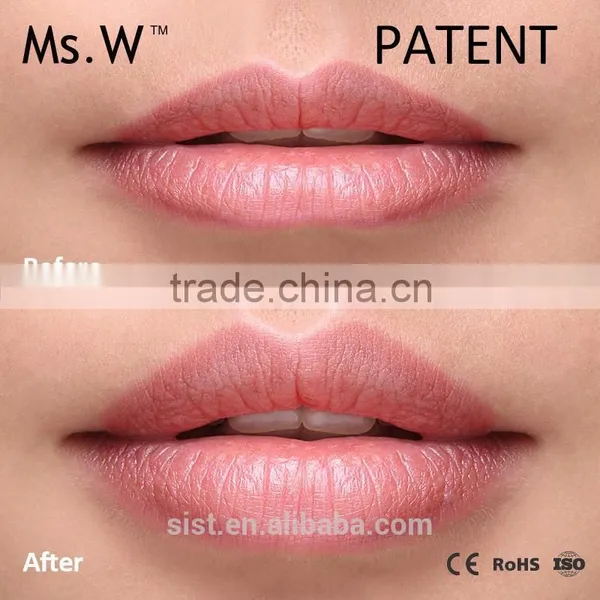 Wholesale Lip Skin Care Electric Beauty Massager Lip Gloss Pen To Get Sexy and Charming Lips photo-6