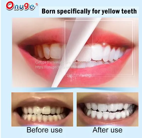Alcohol Free Teeth Whitening Strips photo-2