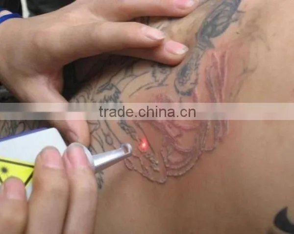 Low Cost nd Yag Laser Machine Color Touch Screen Medical Tattoo Removal Machine photo-5