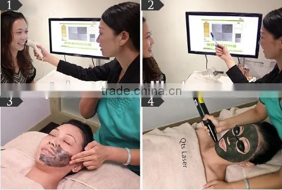 Electro-optic Fast Tatoo Removal Active Q-switch ND: YAG Laser System photo-2