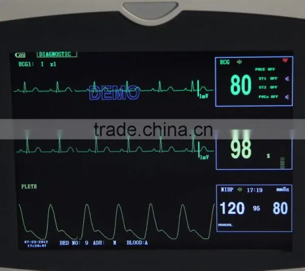 2015 New 8.4-inch 4-Parameters Patient Monitor With Low Price photo-5