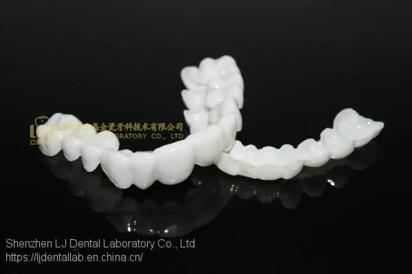 Dental PETG Clip on Veneers, Snap-on-veneers, Smile Veneers, Laboratoire Dentaire, Dentallabor, Laboratorio Dental, Dental Laboratory, Shenzhen LJ Dental Lab China photo-3