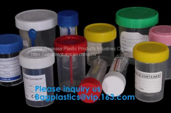 20ml-1000ml Histology Specimen Container Urine Containers, Disposable Medical Consumables Plastic 100ml 120ml Sampling Cup Specimen Container photo-3