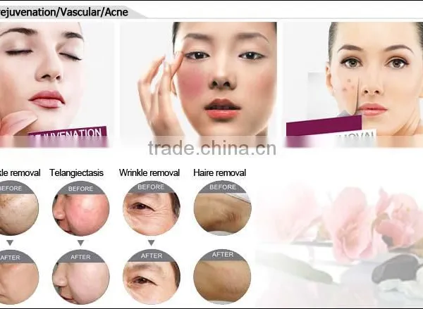 Ce Approved IPL for Face Care Beauty Machine /7 Filters photo-4