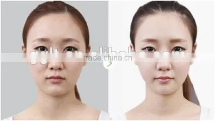 Newest Oxygen Skin Rejuvenation ,pores Removal and Tightening Skin Machine for Salon and Clinic photo-4