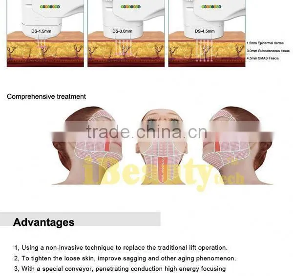 Quality Products CE Products Ultra Age Hifu photo-5
