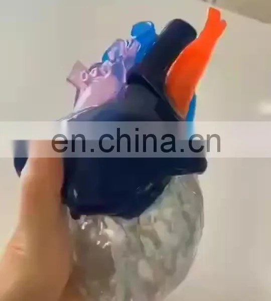 High Accuracy Human Anatomic Model 3D Printing Color Surgical Planning Model