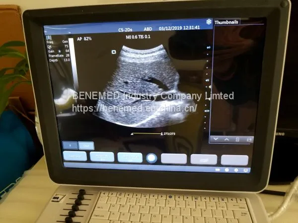 Ultraslim Notebook Type Black and White Ultrasound Scanner Devices photo-3