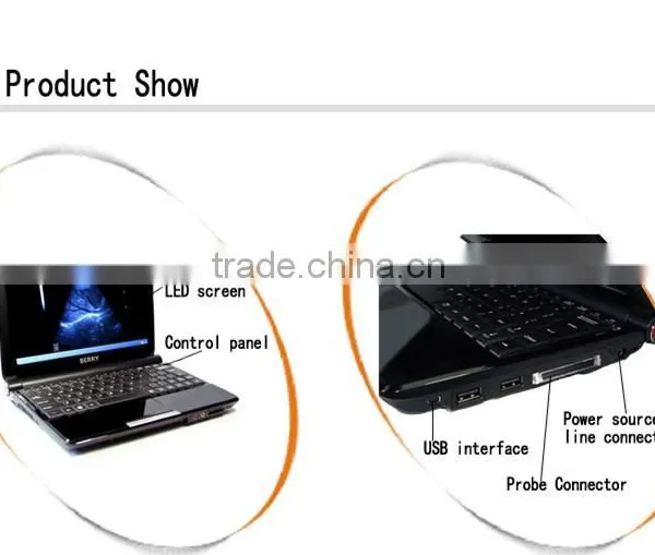 Full Digital Hot Sale B-14 Medical B&W Portable Ultrasound Machine photo-5