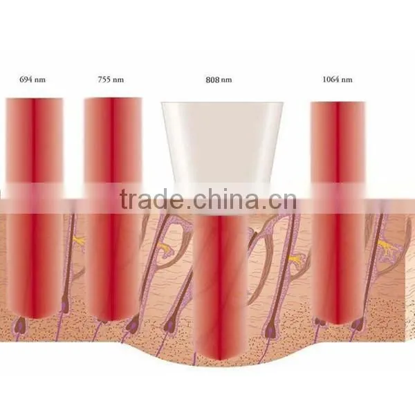 Gglt Diodo 808 Laser Hair Removal System 808nm Diode Laser Hair Reduction Equipments photo-2