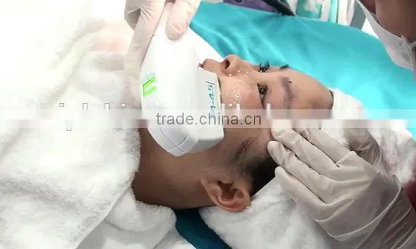 Ultra Lift Face Lift Focused Ultrasound Skin Tightening HIFU Device - IHifu S photo-4