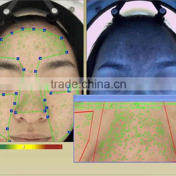 Facial Checking Device/skin Analyzer Scope/portable Facial Skin Analyzer photo-6