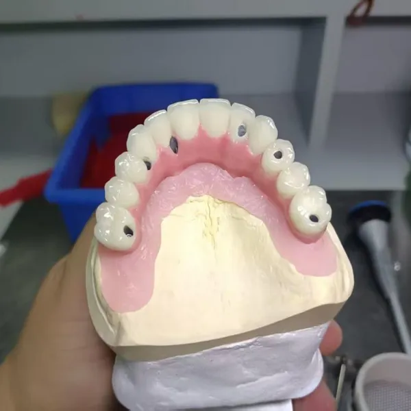 CAM Milled Titanium Bar Dental Implant Hybrid Prosthesis Dentures Metal Implant Bar photo-4