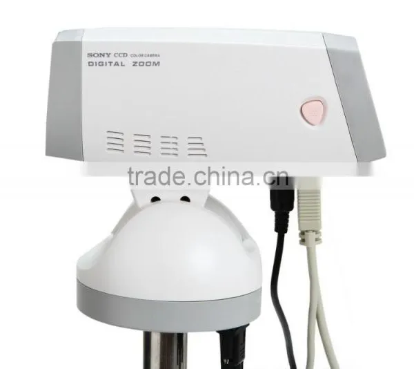 PC Software Digital Electronic Colposcope For Clinical Detection photo-5