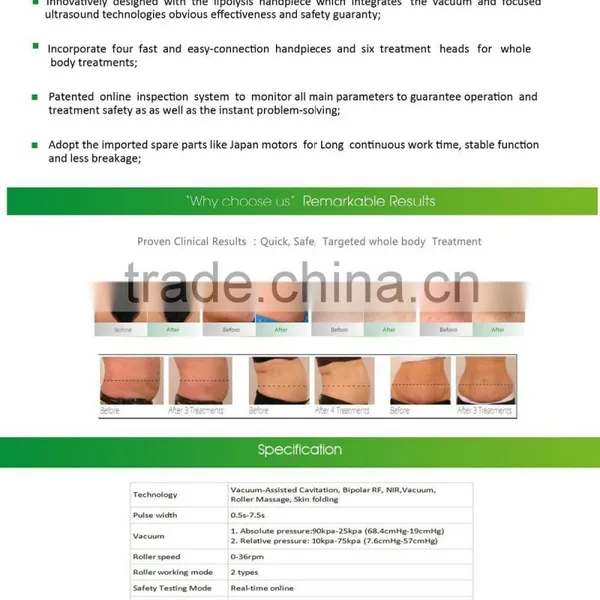 Best rf Skin Tightening Face Lifting Machine RF Beauty Machine photo-3