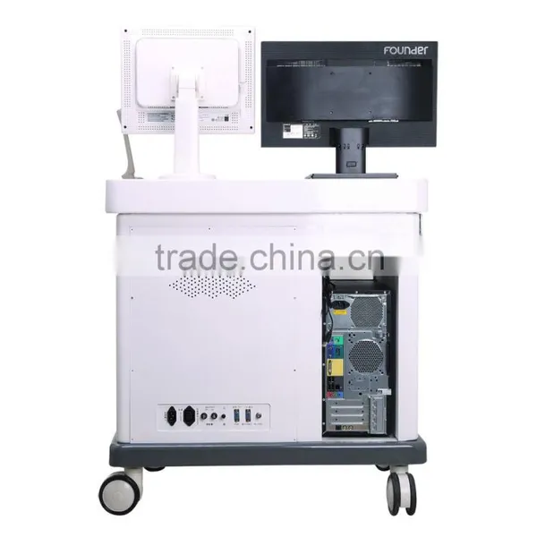 Portable Ultrasound /ultrasound Machine / 4d/3d/2d Ultrasound Scanner With Printer2018CIV photo-2