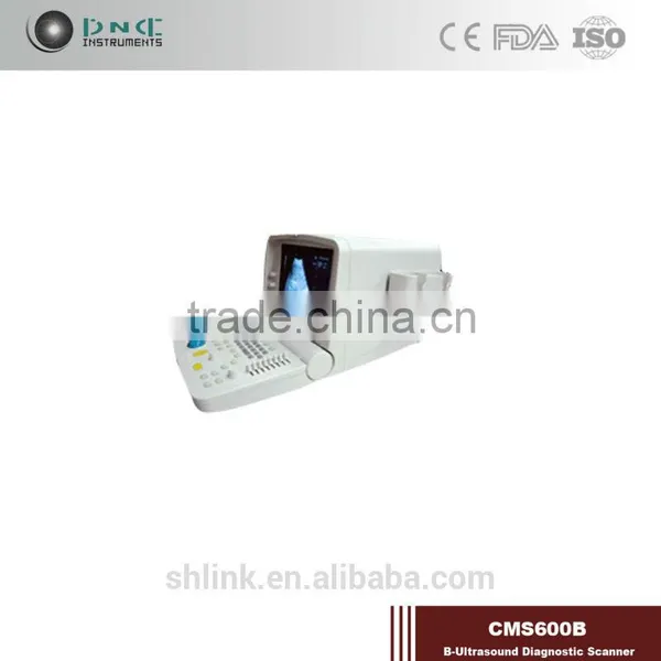 Top Grade Hotsale Link Digital Non-Interlaced Portable Ultrasound Scanner 200D With Low Price photo-4