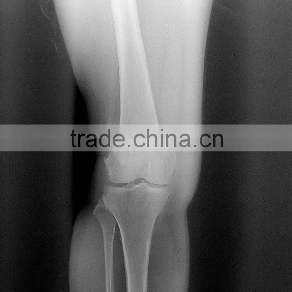 Medical X-ray DR Panel Detector photo-5