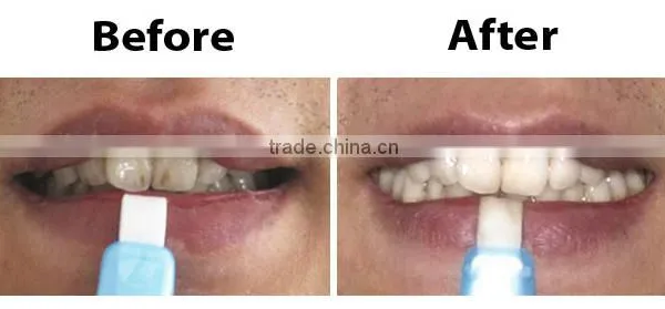 Magic Brush Teeth Cleaner photo-2