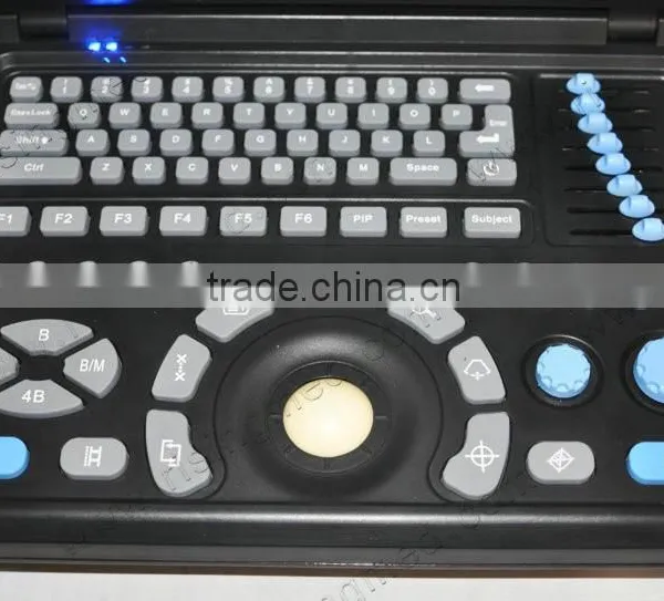 100% Warranty CE ISO Approved 10.4 Inch Laptop Ultrasound Machine/Scanner With 3.5Mhz Convex Probe Linear Transvaginal Rectal photo-2