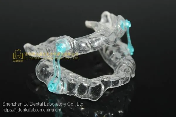 Anti-snoring Device, Dental Sportguard, Occlusal Splint, Laboratoire Dentaire, Dentallabor, Laboratorio Dental, Dental Laboratory, Shenzhen LJ Dental Lab China