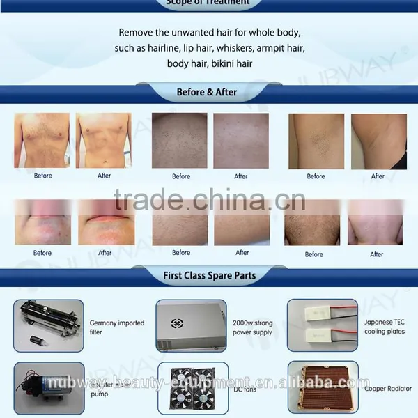 2017 New Design Laser Diodo Hair Removal/ Electric Hair Removal Machine Epilator/Nubway Laser Hair Removal Equipment for Sale photo-4