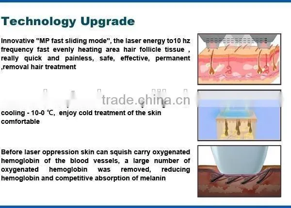 Real Factory Supply High Quality Diode Laser Hair Removal 808nm(CE,ISO13485,ROHS,TUV,BV) photo-4