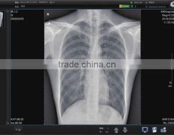 Wired or Wireless High Resolution Flat Panel Detector for Sale photo-3