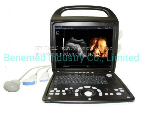 Premium 4D Color Doppler Ultrasound Scanner
