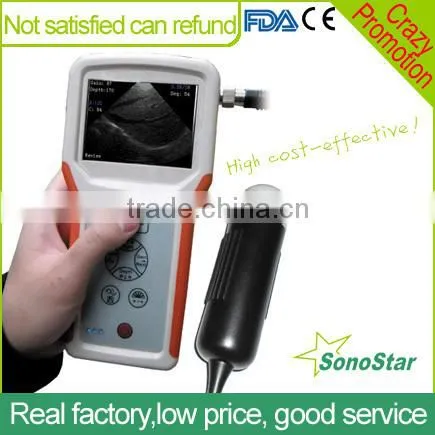 Sonostar Advanced Mini Portable Ultrasound Machine Handheld Ultrasound Scanner V1