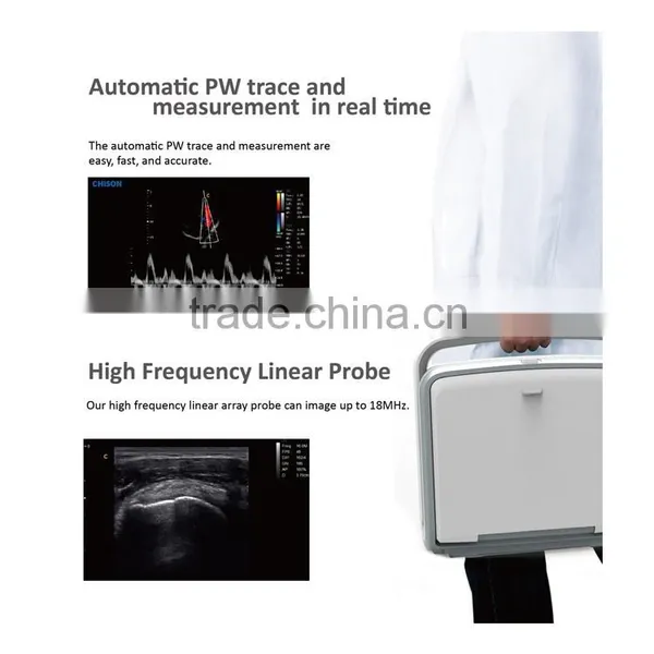 Laptop Color Doppler Ultrasound Price & Portable Color Doppler Ultrasound Machine photo-2