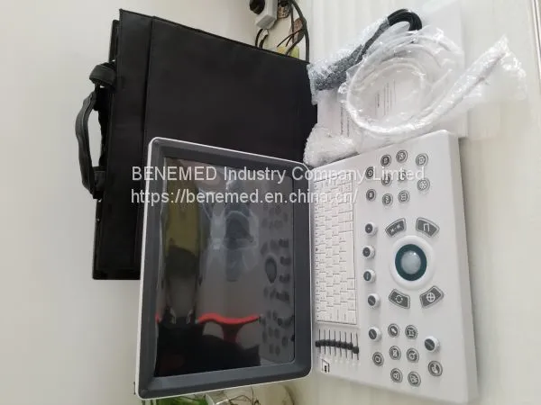 Ultraslim Notebook Type Black and White Ultrasound Scanner Machine Bw-8 photo-4