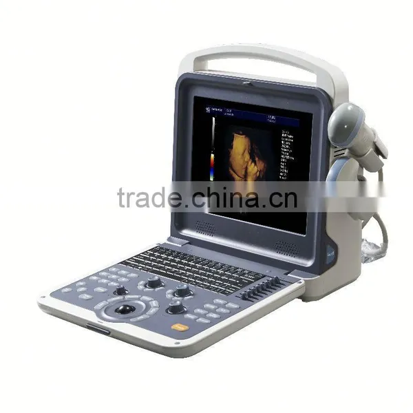 2016 NEW 4d Color Doppler Ultrasound Price Intelligently With Fetus