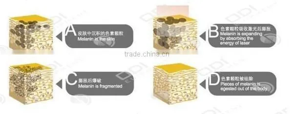 3 in 1 OD-IRL10 Multifunctional rf nd Yag q Switch Ipl Laser Hair Removal Machine for Sale for Aesthetic photo-2