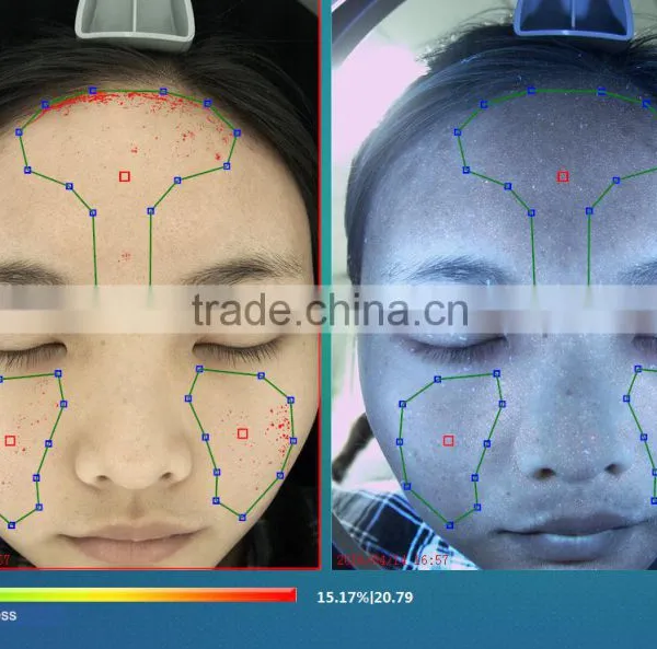 High Pixel Skin Pigmentation/acne/spot/pore/wrinkle/roughness/sensitivity/cosmetics Test Machine photo-5