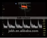 2016 NEW Ultrasound Scanner Color Doppler photo-2