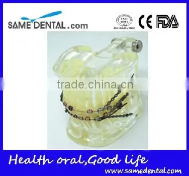 Dental Model Transparent Orthodontic Models Dental Eduction Assitant No. DEA-08 photo-2