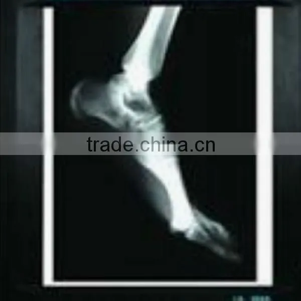 X-ray Film Kodak
