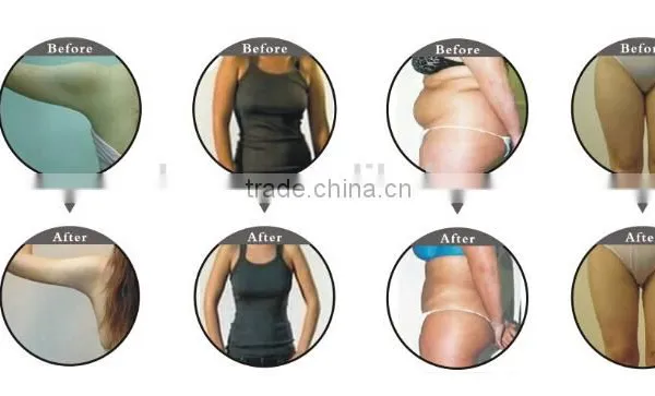 5 In 1 Cavitation Machine Professional Cavi Lipo Laser /rf 2mhz Cavitation Lipolaser Slimming Lipolaser Machine photo-5