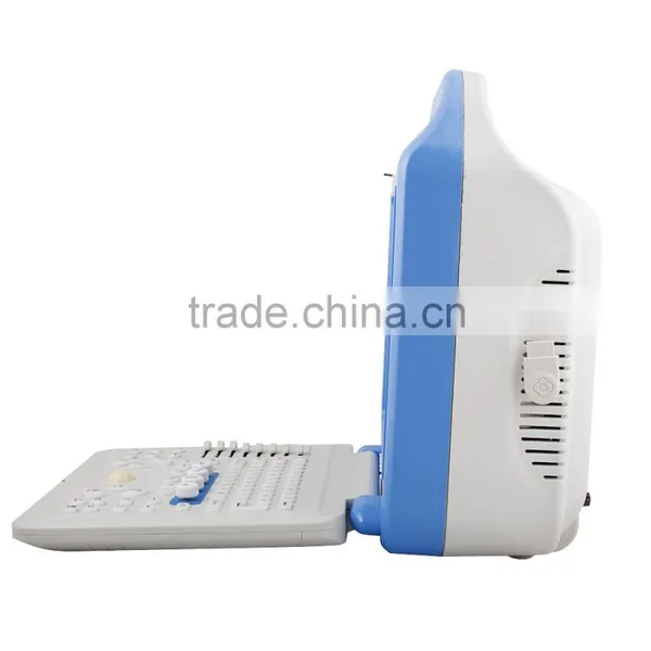 New Portable Full Digital Color Doppler Ultrasound Scanner Diagnostic System 2 Probe With Cheap Price photo-6