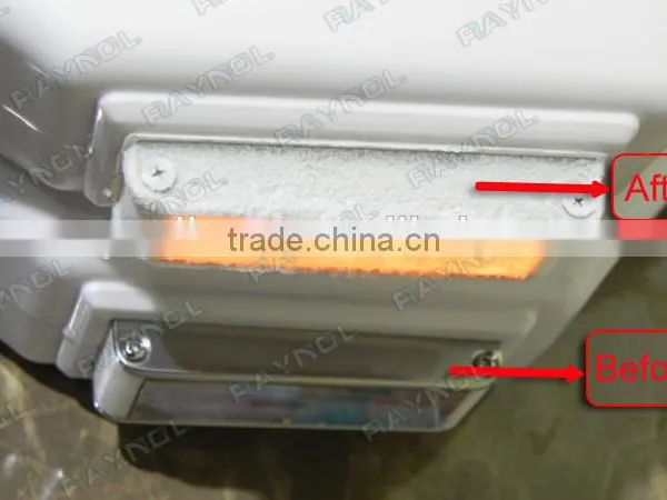 2015 Hot Sale in Clinic Permanent Hair Removal Machine IPL photo-5