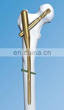 Orthopedic Trauma Implants PFNA photo-2